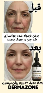 روغن زیتون اوزنه شده چین وچروک